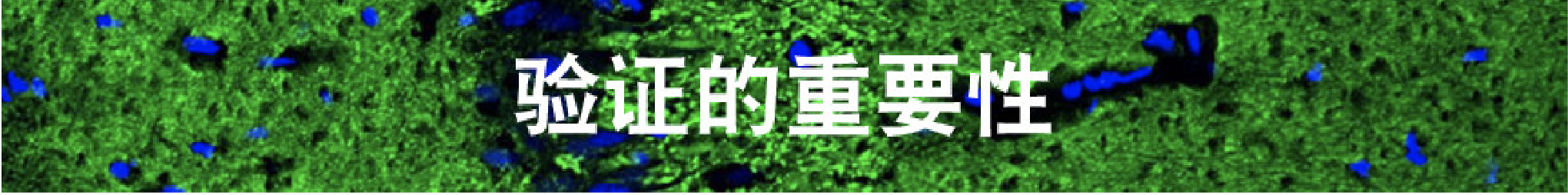 免疫荧光(IF)成功三要素，重要！