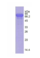转铁蛋白(TF)天然蛋白