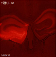 AAV介导shRNA干扰