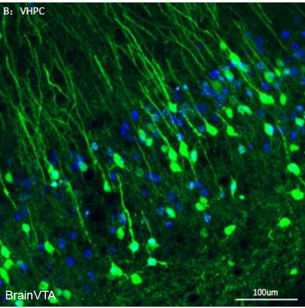 神經示蹤逆向跨單突觸病毒RV-EnVA-△G-EGFP