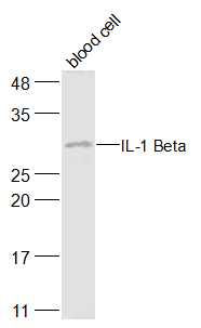 白介素1β/IL-1β抗体