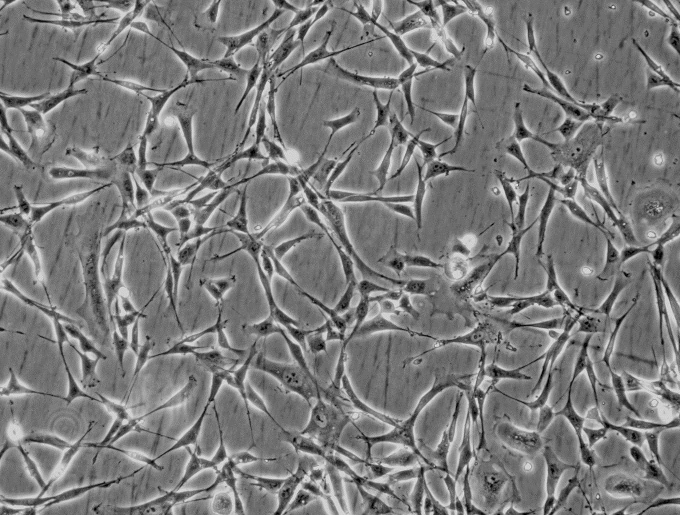 大鼠纹状体神经元细胞 RN-s