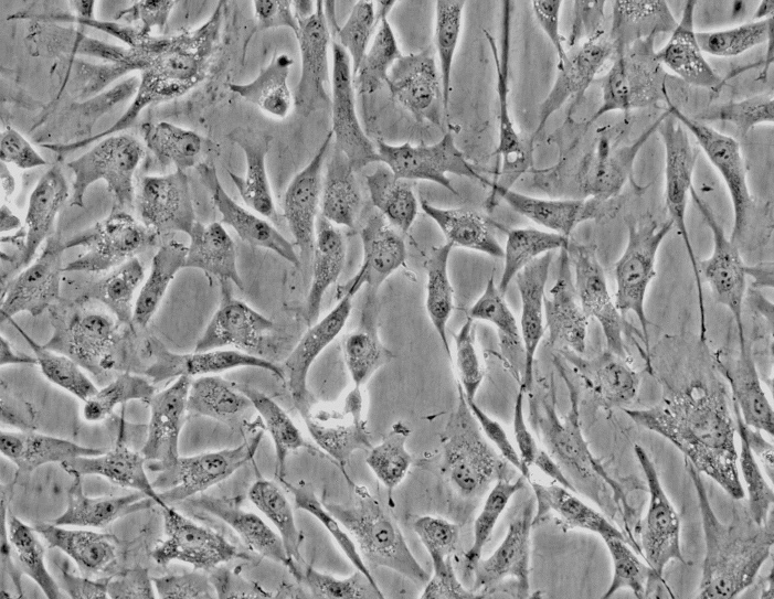 人子宫成纤维细胞 HUF