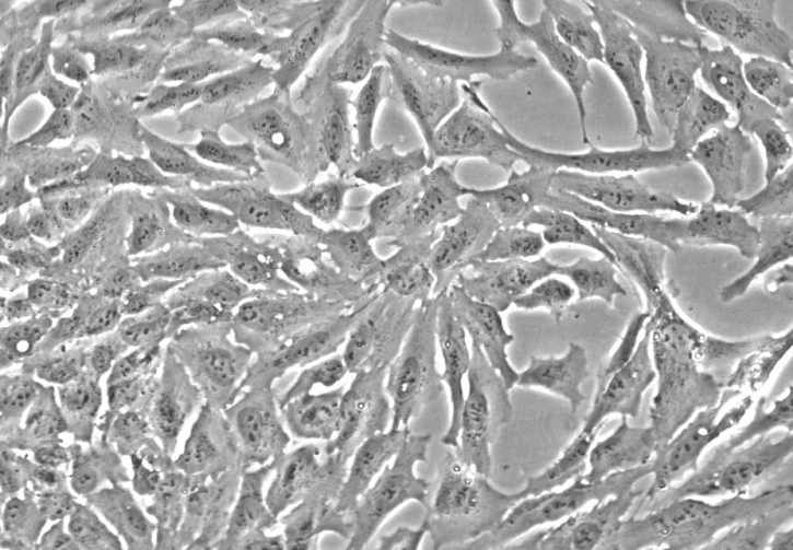 大鼠肝脏星形细胞-成年RHSteC-a