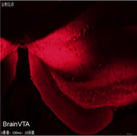 化学遗传激活 rAAV-CaMKIIα-hM3D(Gq)-mCherry