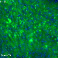 光遗传（光激活、高频）rAAV-CaMKIIα-hChR2(E123T/T159C)-EYFP