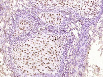 泛素蛋白单克隆抗体