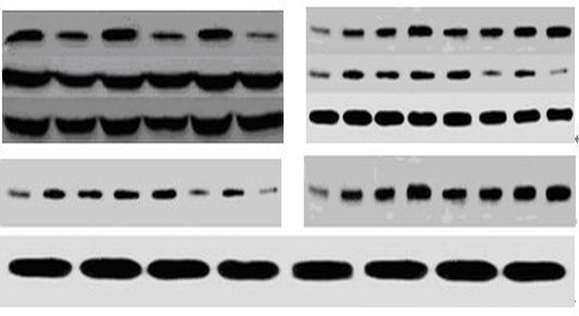 WB免疫蛋白印迹