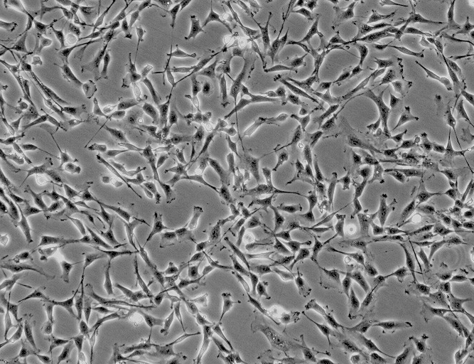 非洲绿猴SV40转化的肾细胞,COS-7