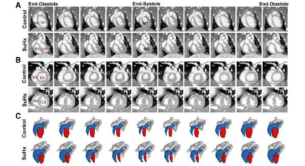Micro-CT 用于心脏功能评估，为医疗技术进步助力