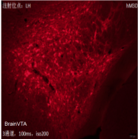 rAAV-EF1α-DIO-hM3D(Gq)-mCherry-WPREs