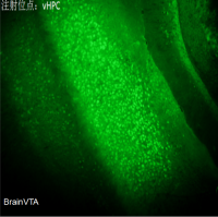 低频钙成像AAV病毒rAAV-CaMKIIα-GCaMP6s