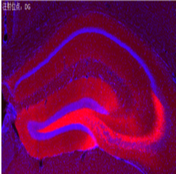 光遗传（光激活、高频）rAAV-CaMKIIα-hChR2(E123T/T159C)-mCherry