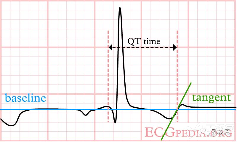 查房实录|我们真的会『正确』测量qt/qtc间期了吗?