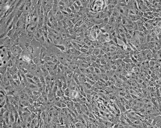人脐静脉细胞融合细胞，EA.hy926