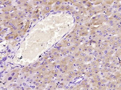 甲胎蛋白单克隆抗体