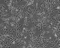 人乳腺癌细胞，MCF7 [MCF-7]