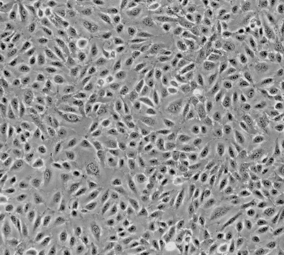 人肺腺癌细胞，NCI-H1395