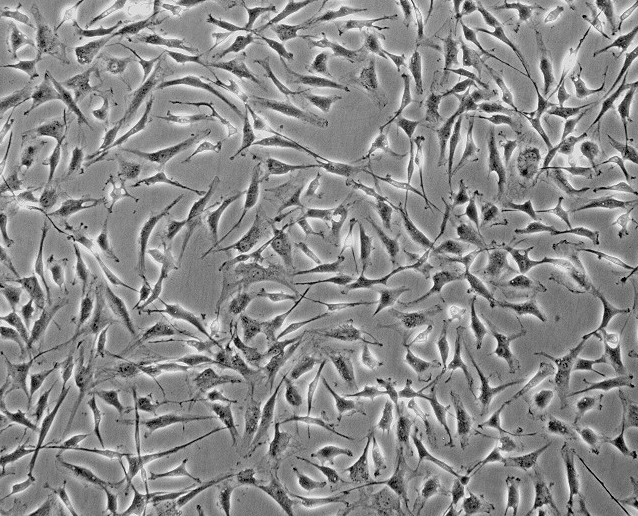 原代白癜风人皮肤黑色素细胞,PIG3