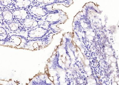 小鼠抗绒毛蛋白单克隆抗体