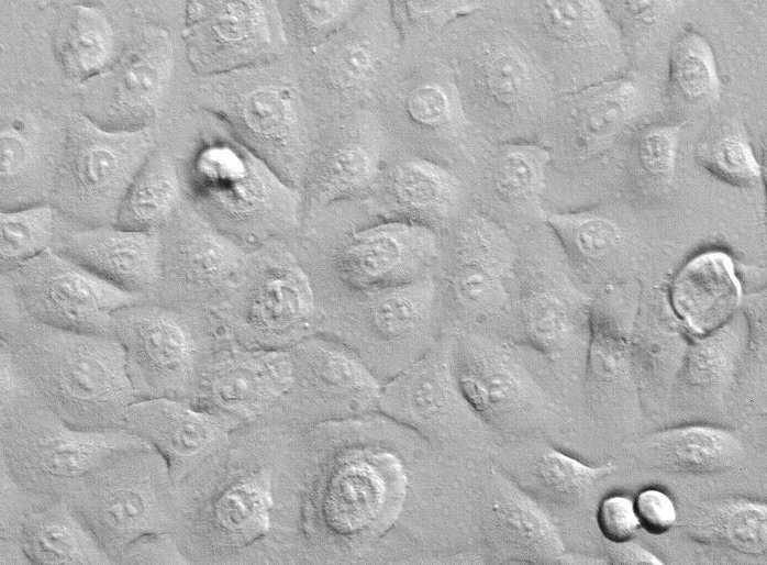 人胸膜间皮瘤细胞,SMC-1