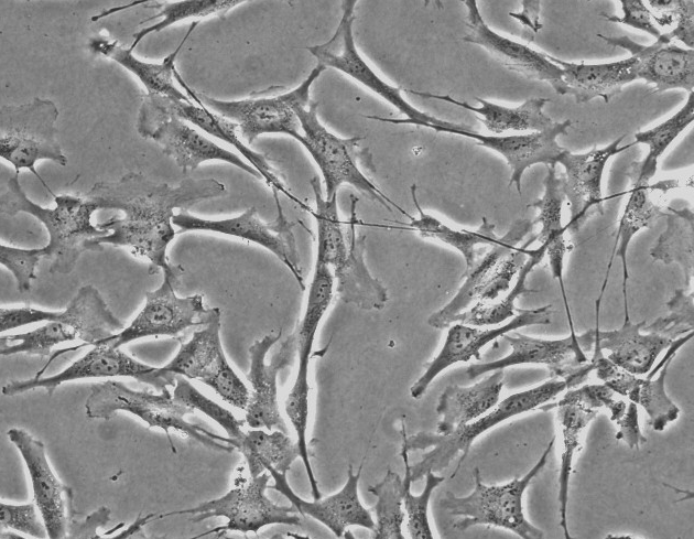 小鼠脑神经瘤细胞，Neuro-2a