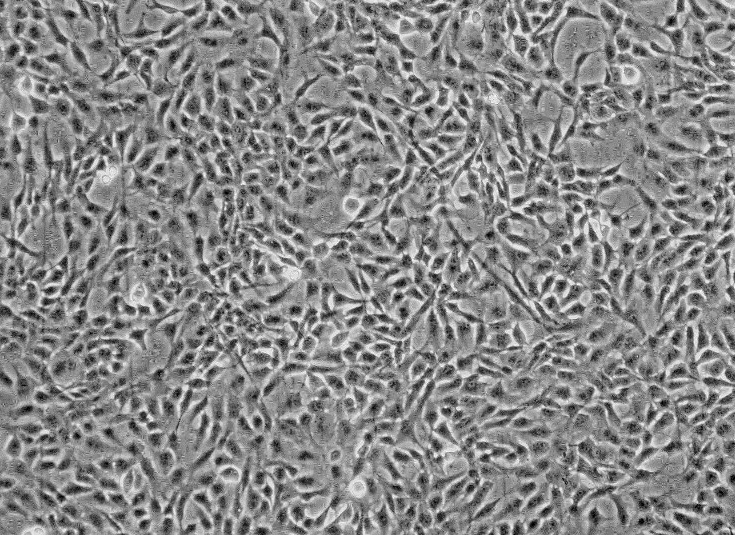 小鼠卵巢癌细胞，OVHM