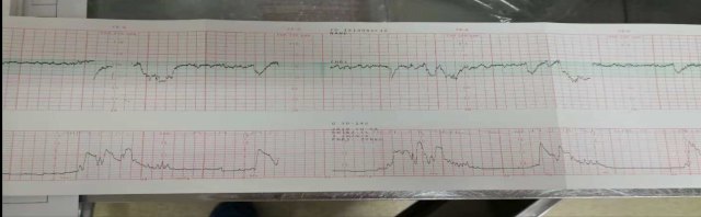 04胎心 WechatIMG63.jpeg