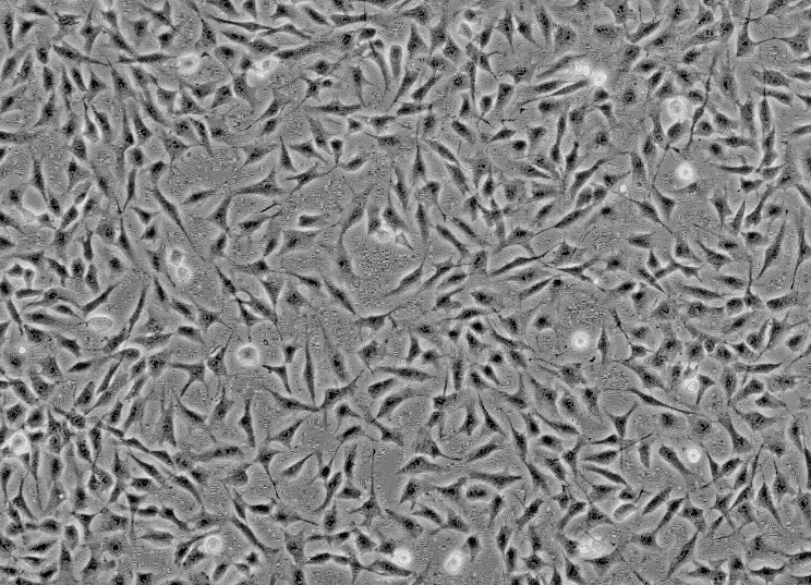 小鼠胶质瘤细胞，GL261