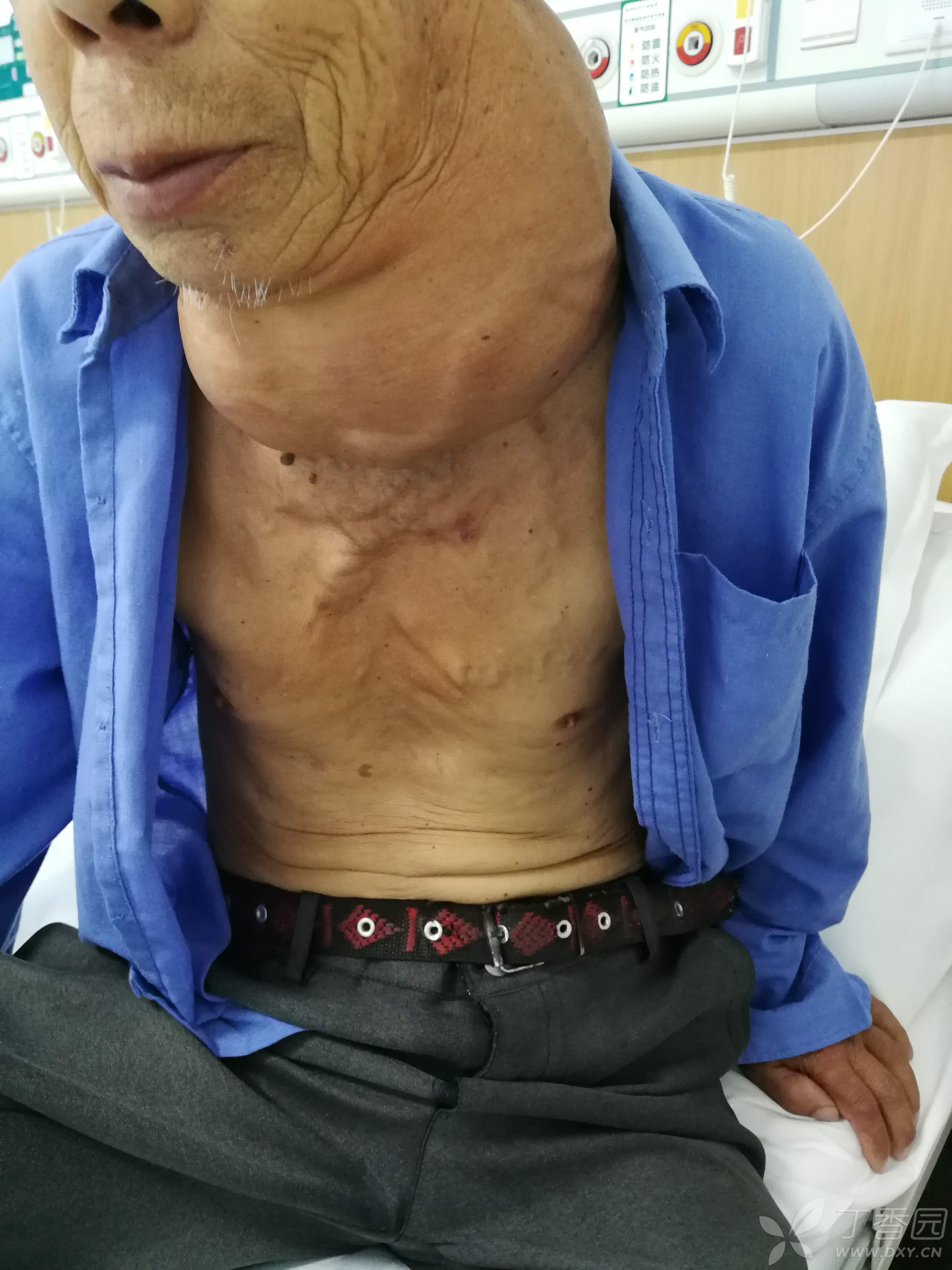 优质难得一见的"大脖子"