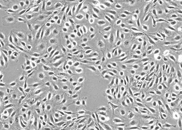 人视网膜色素上皮细胞，D407