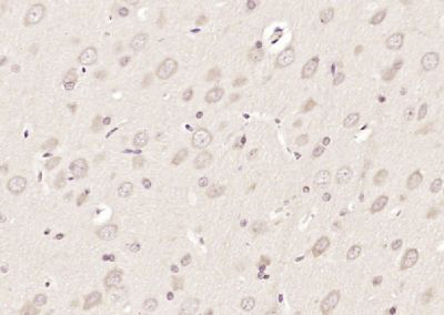 ATP结合盒转运蛋白2抗体