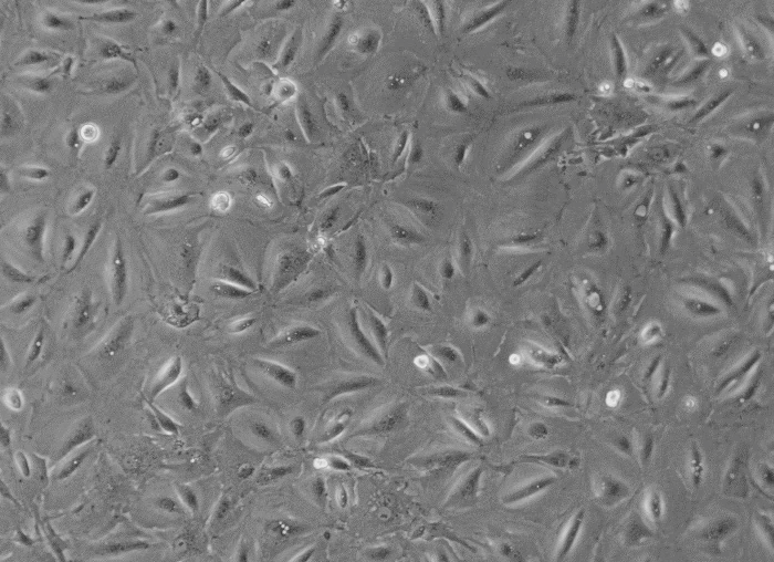 人急性T淋巴细胞白血病细胞，CEM-C7