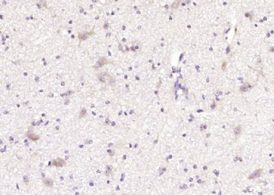 AFG3样蛋白2/脊髓小脑共济失调蛋白28抗体