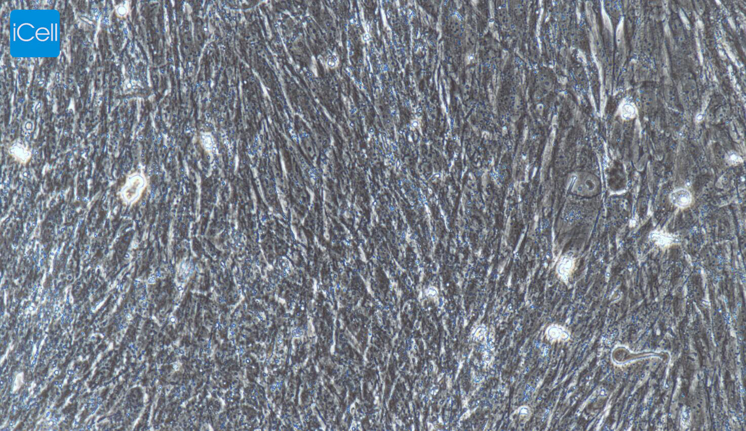 人膀胱成纤维细胞/免疫荧光鉴定/镜像绮点（Cellverse）