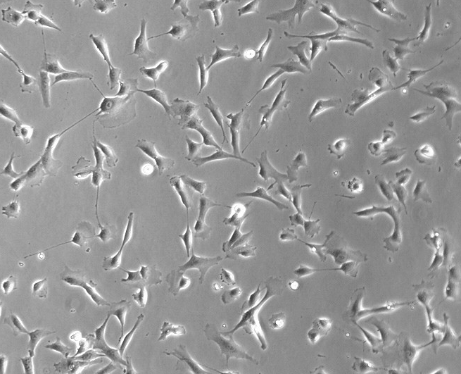 大鼠卵巢癌细胞，Nutu19