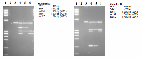 Y 染色体微缺失检测原理及其重要性