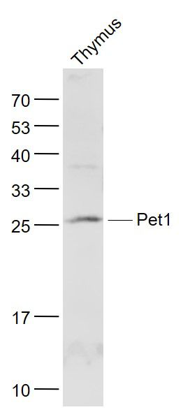 ETS结构域转录因子FEV抗体