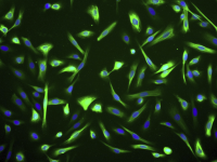 人子宫颈上皮细胞MatchPair™: 宫颈上皮和肿瘤原代细胞