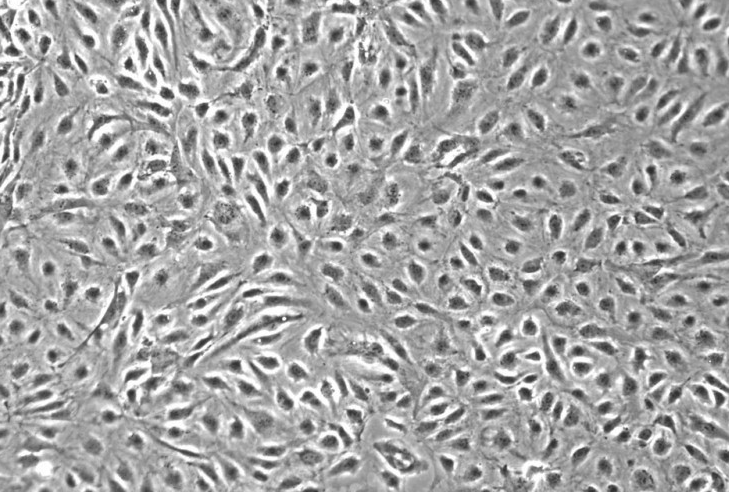 人支气管成纤维细胞完全培养基