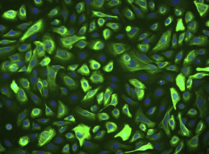 人卵巢癌组织源细胞生长因子