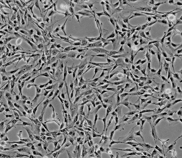 人肾癌成纤维细胞生长因子