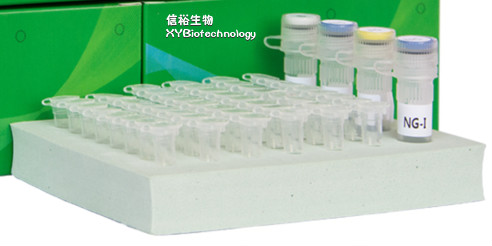 对虾肝胰腺坏死性细菌（NHPB）核酸检测试剂盒（恒温荧光法）