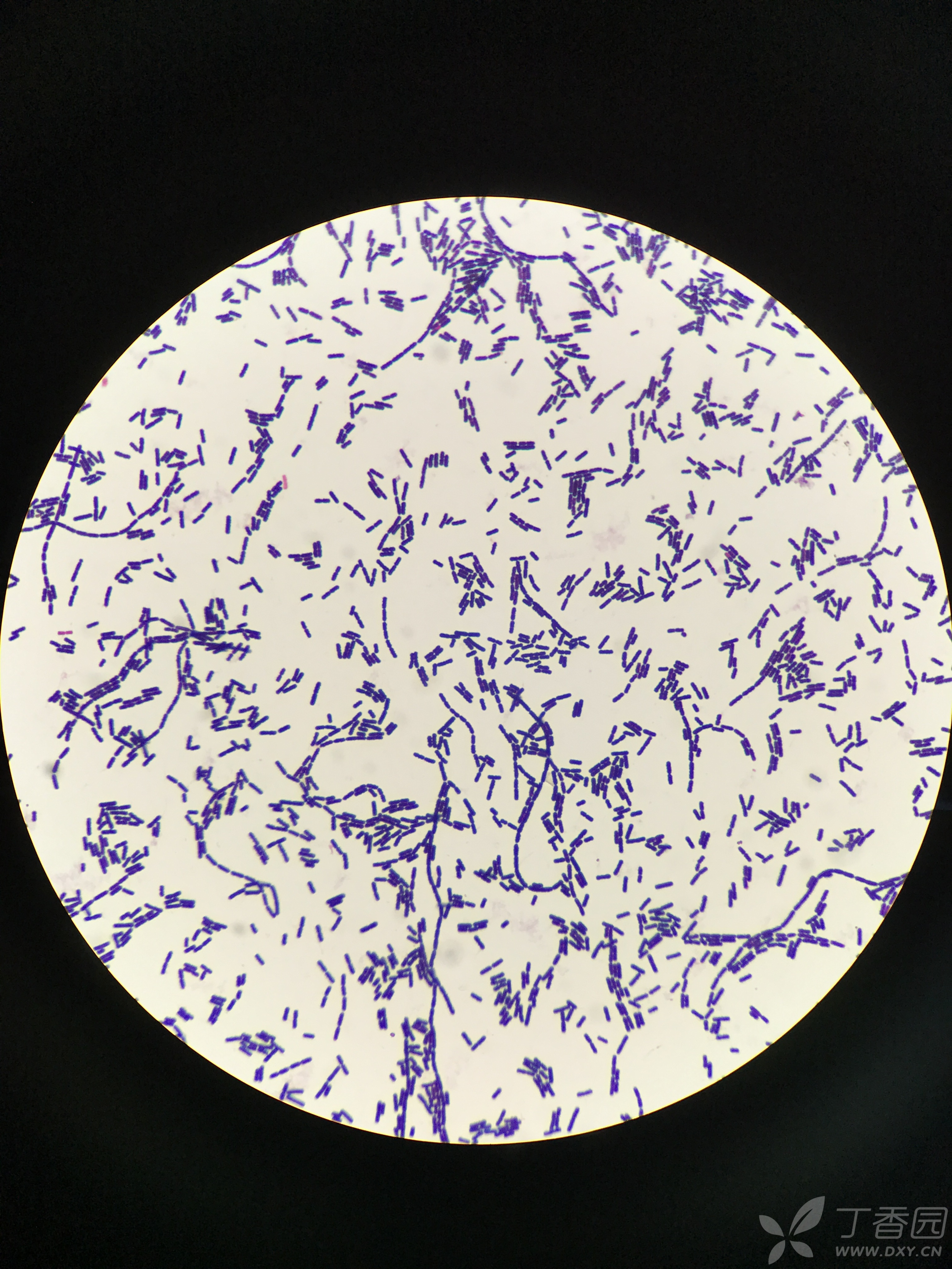 革兰阳性芽孢杆菌
