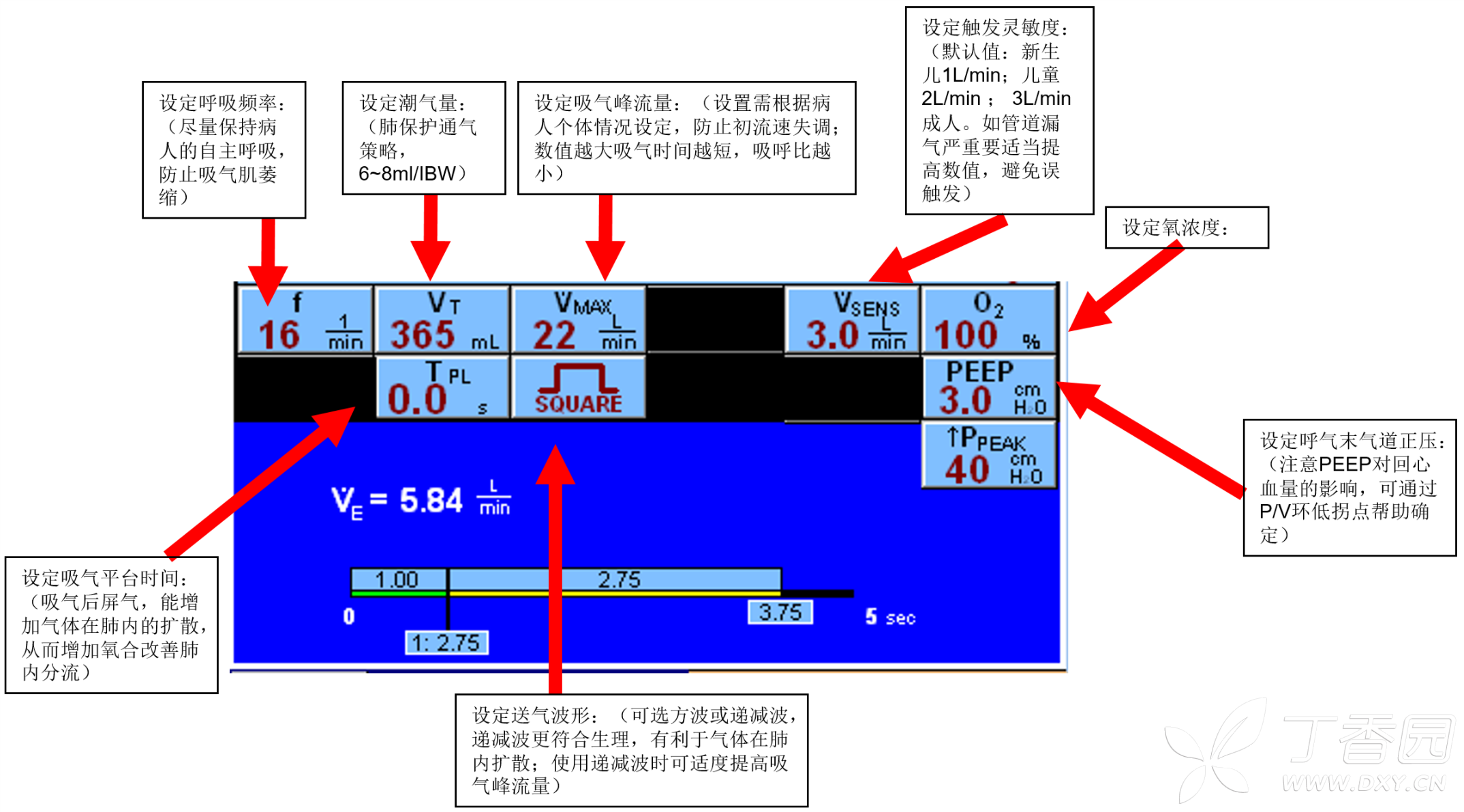 有創呼吸機的參數設置