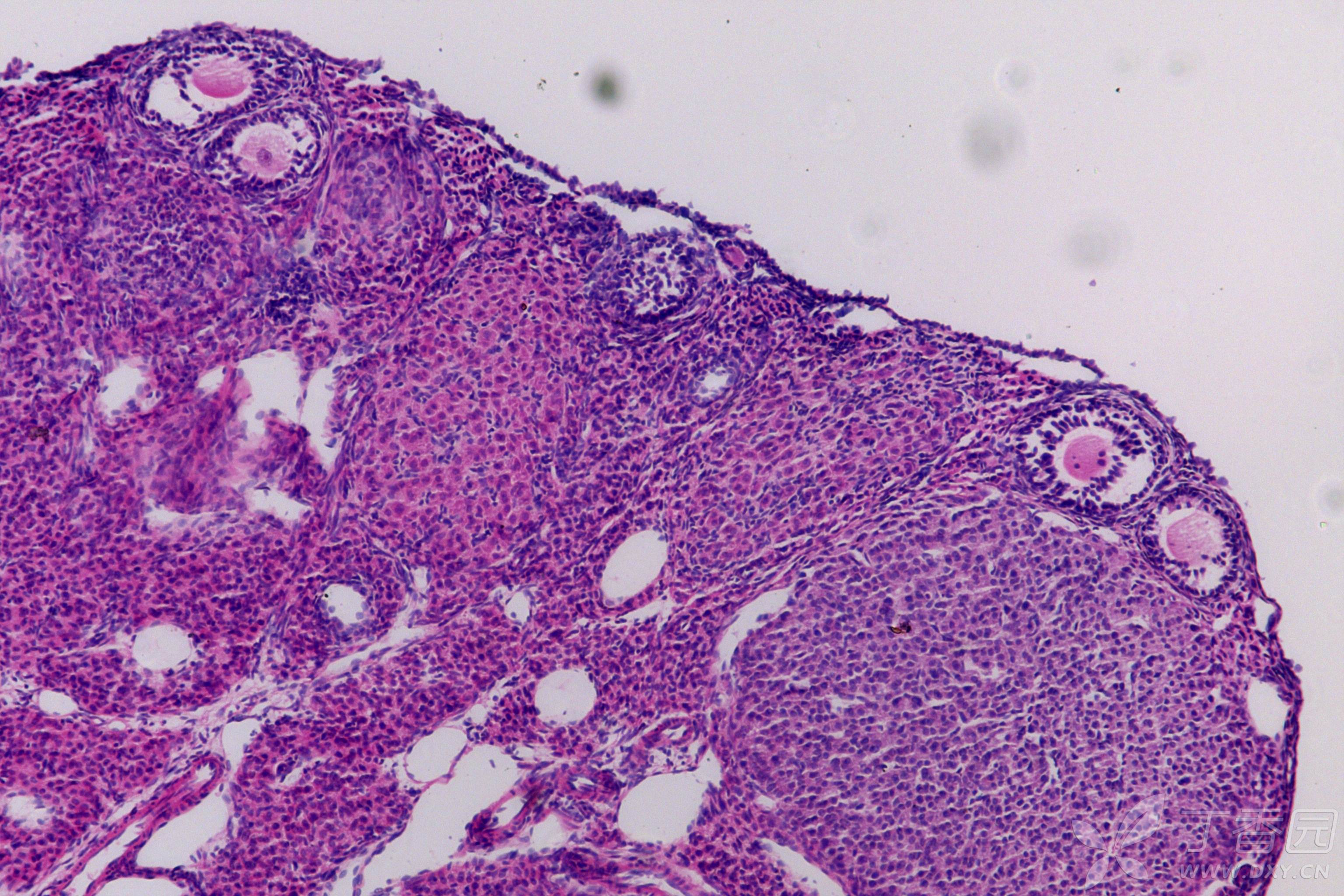 小鼠卵巢石蜡切片细胞变形且间隙增大有裂痕