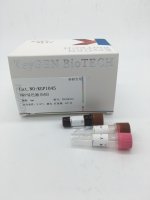 DAB显色液（液体装）