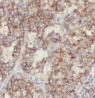 PCDH15| PCDH15 antibody