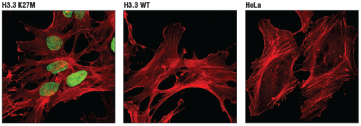 肿瘤的表观遗传学，经典&热门靶点从这里开始