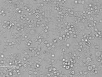 K-562人慢性髓原白血病细胞